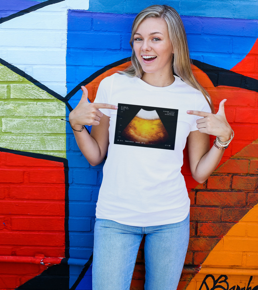 Beer Ultrasound Image Not Safe For Liver T-Shirt