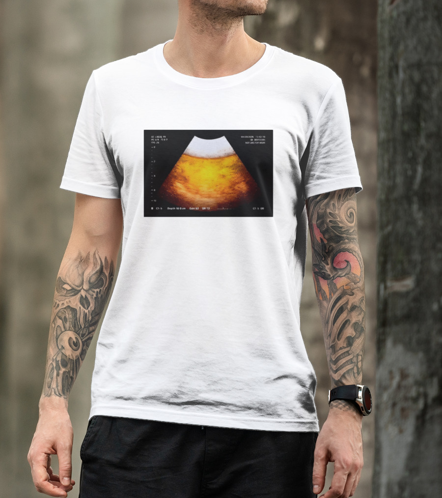 Beer Ultrasound Image Not Safe For Liver T-Shirt