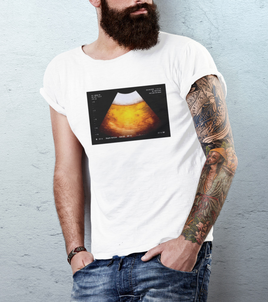 Beer Ultrasound Image Not Safe For Liver T-Shirt